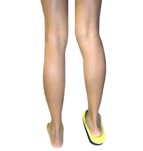 How to diagnose short legs?
