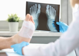 Foot surgery, its types and complications
