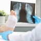 Foot surgery, its types and complications