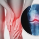 8 simple and effective exercises to strengthen the knees