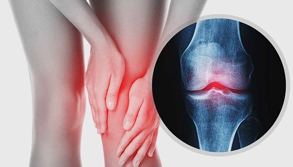 8 simple and effective exercises to strengthen the knees