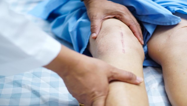 Learn more about knee replacement surgery