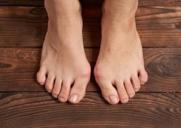 Causes of deviation of the big toe